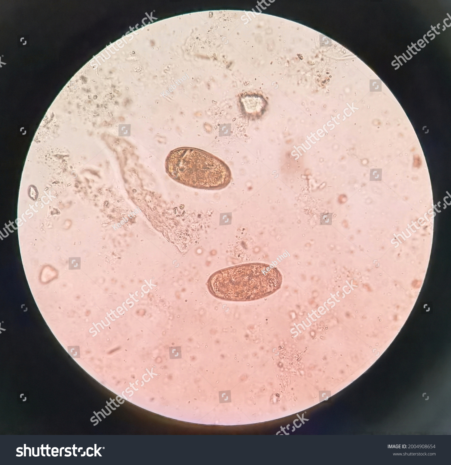 This Paragonimus Spp Egg By Microscopic Stock Photo 2004908654 ...