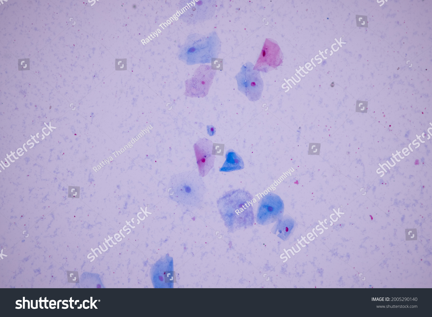 Characteristics Anatomy Histological Sample Squamous Epithelial Stock ...