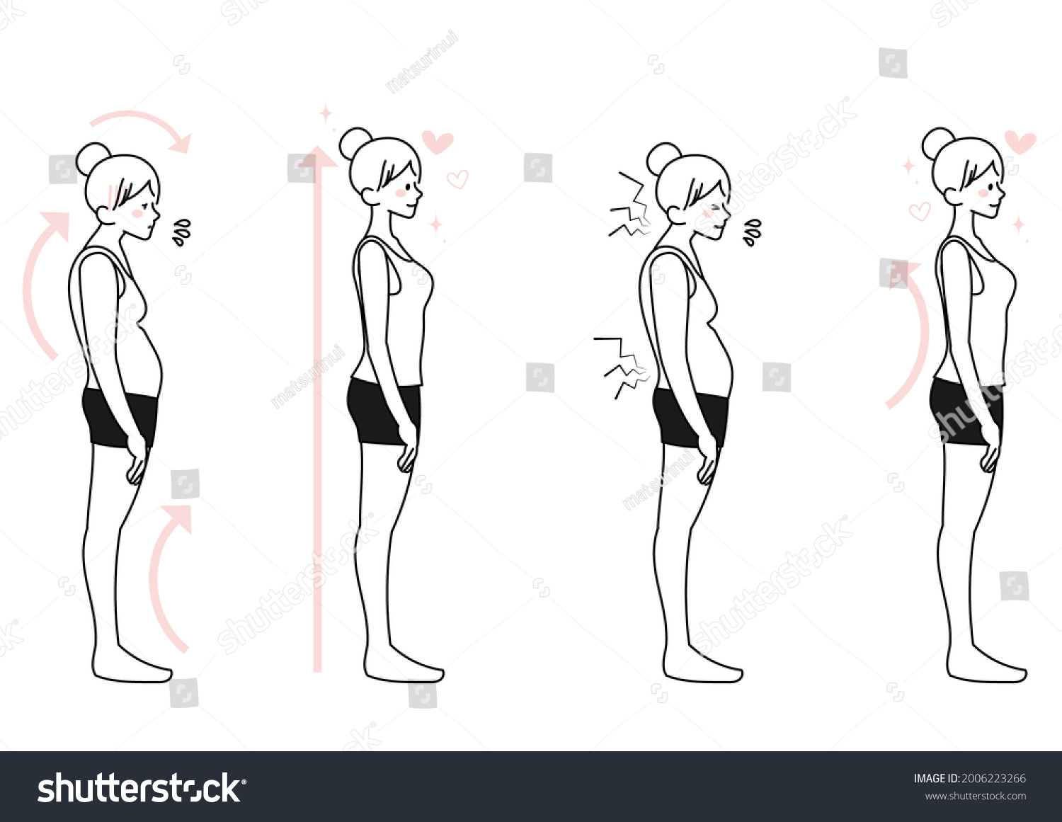 Female Illustration Set Stoop Straight Posture Stock Vector (Royalty ...