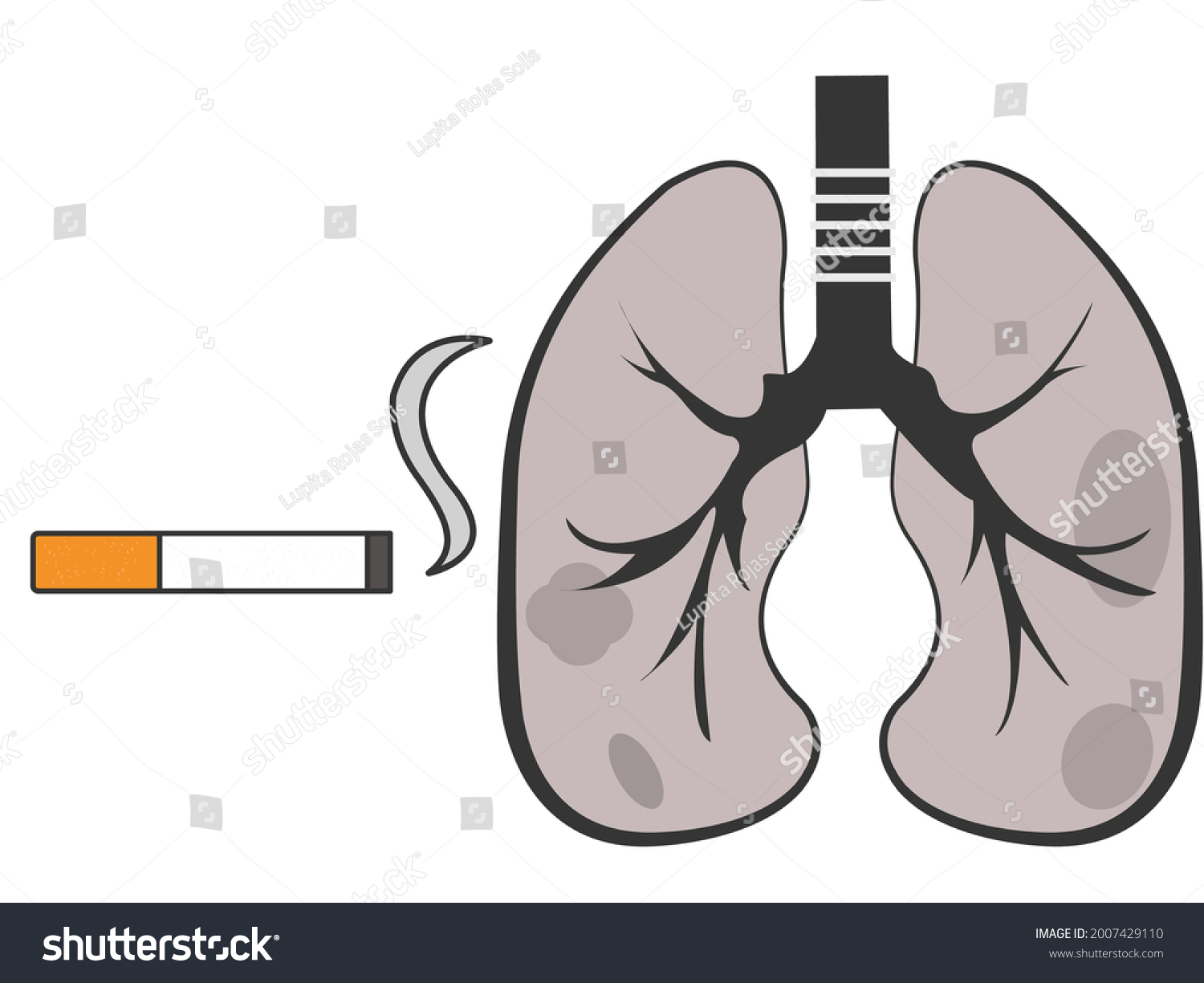 Sick Lungs Smoking Much Stock Vector (Royalty Free) 2007429110 ...