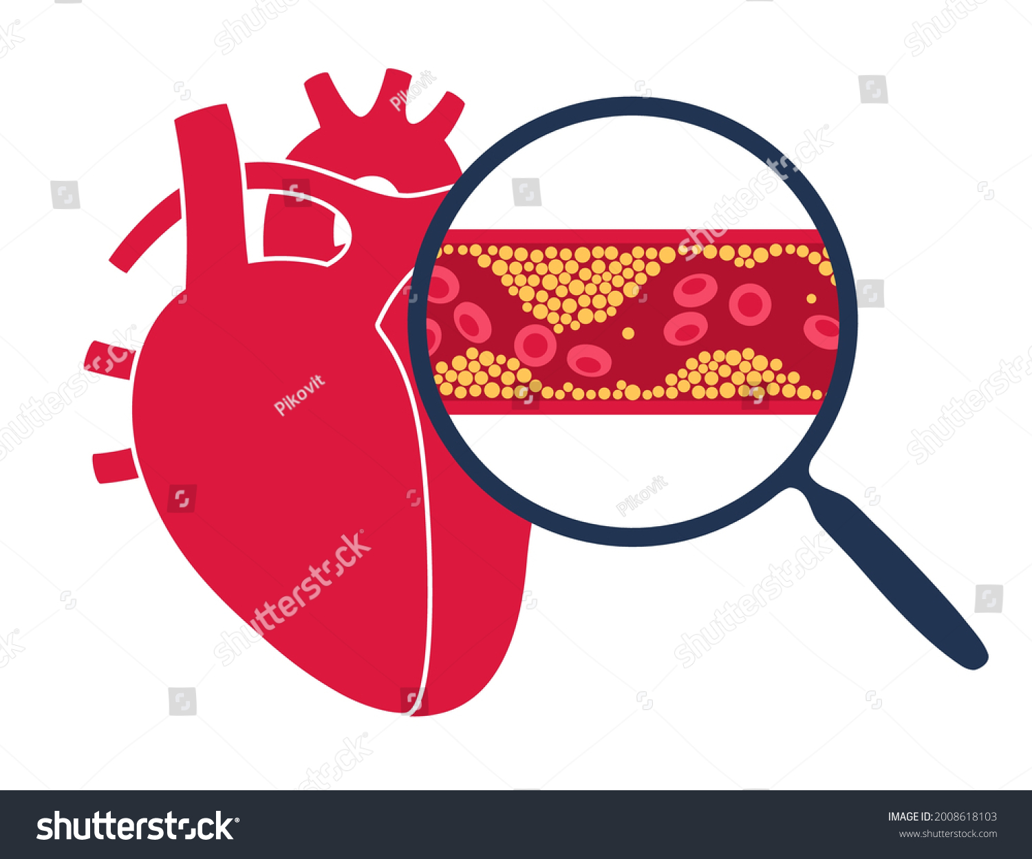 Cholesterol Human Blood Vessels Heart Logo Stock Vector (Royalty Free ...