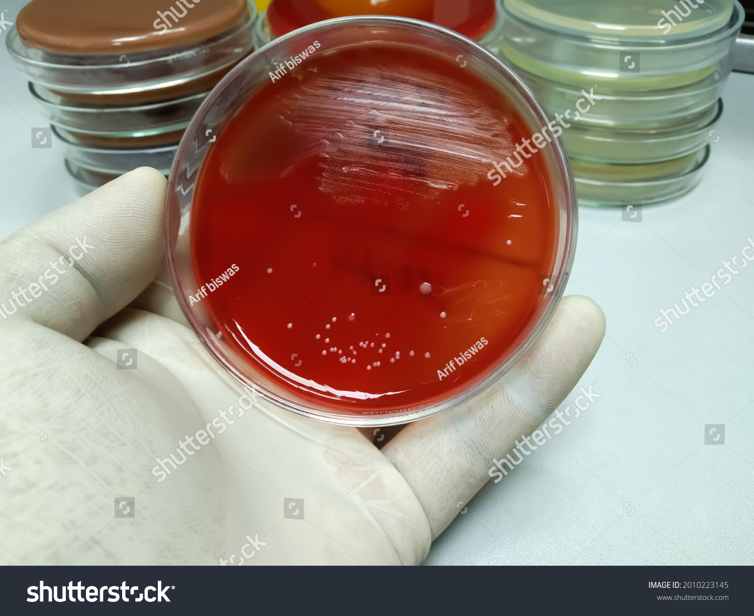 Blood Agar Medium Growth Streptococcus Staphylococcus Stock Photo ...