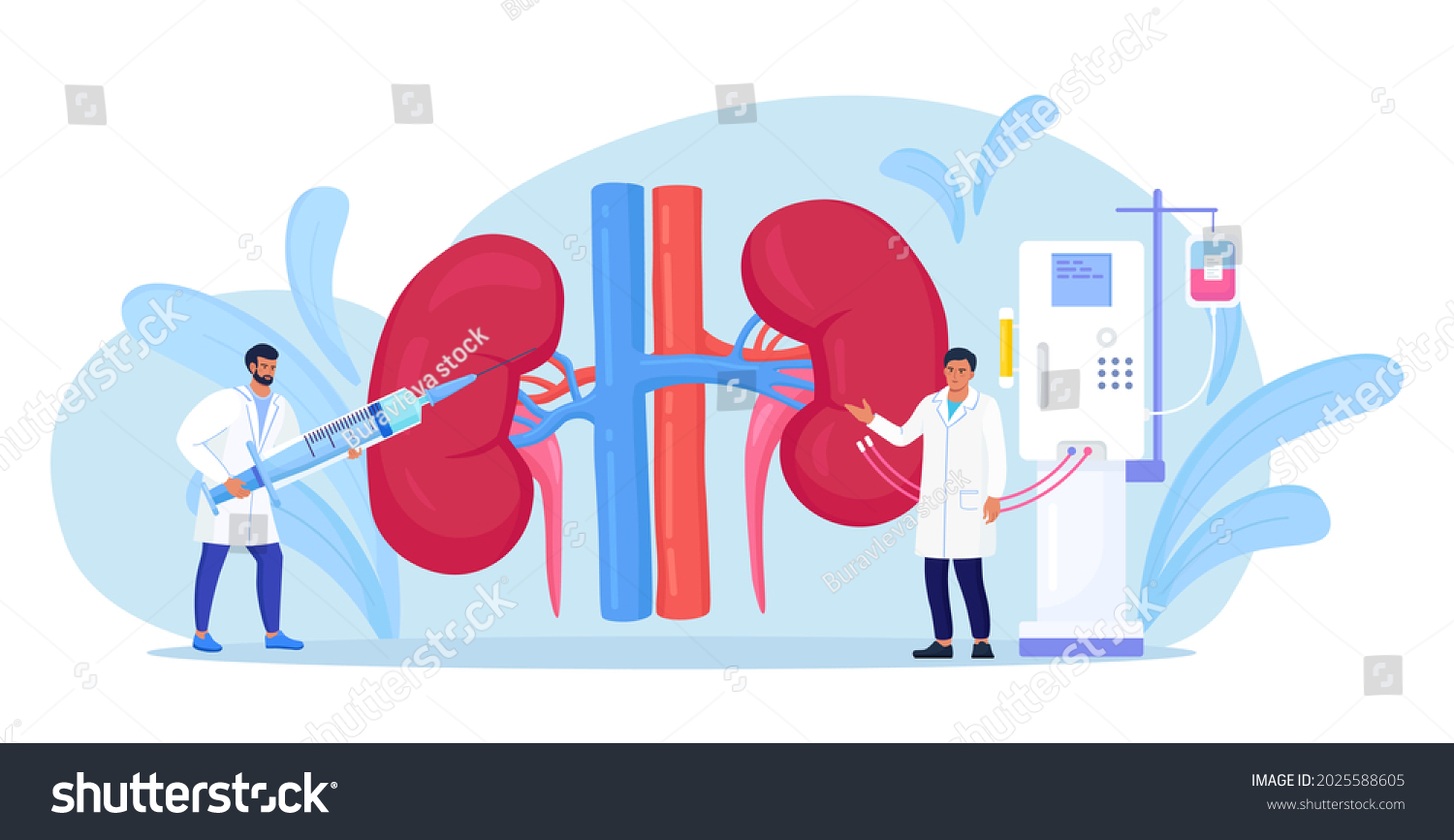 Hemodialysis Blood Purification Chronic Renal Failure Stock Vector ...