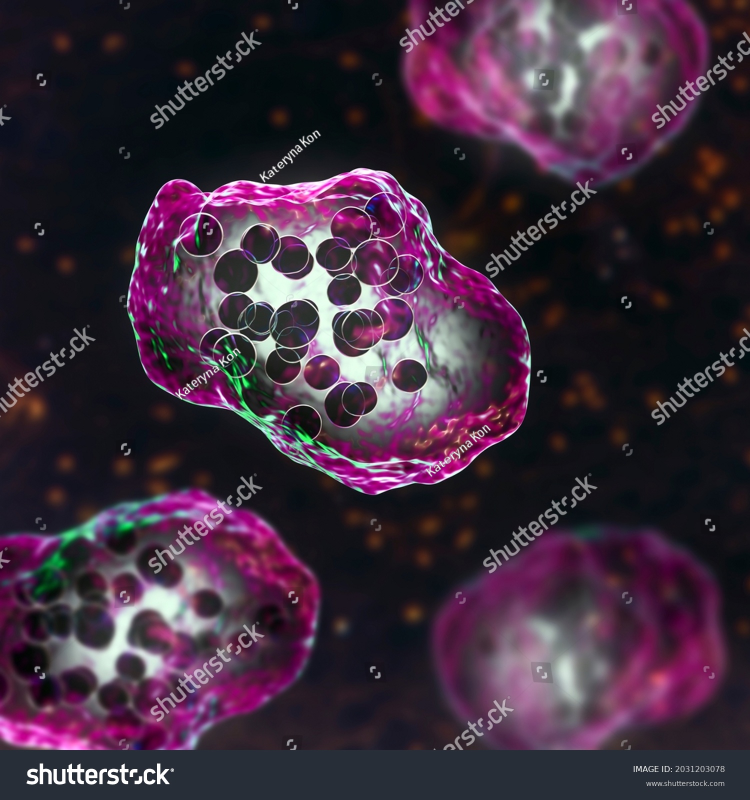 Measles Disease Giant Multinucleated Cells Seen Stock Illustration ...