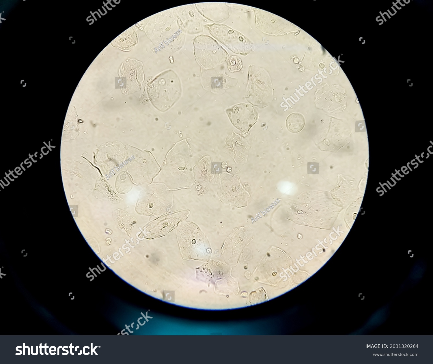 Epithelial Cells Urine Under Microscope Urinalysis Foto Stok 2031320264 Shutterstock 1818