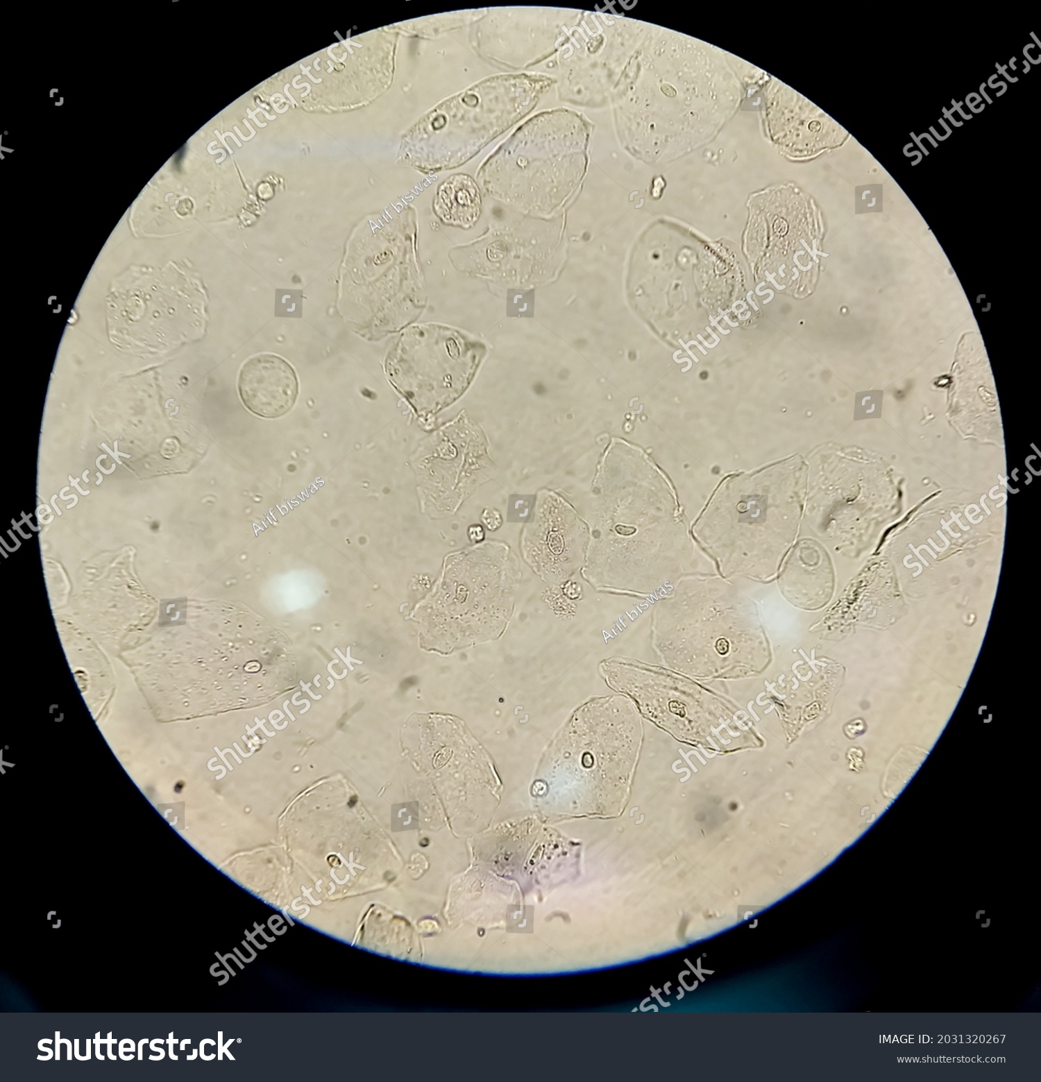 Epithelial Cells Urine Under Microscope Urinalysis Foto Stock 2031320267 Shutterstock 6243