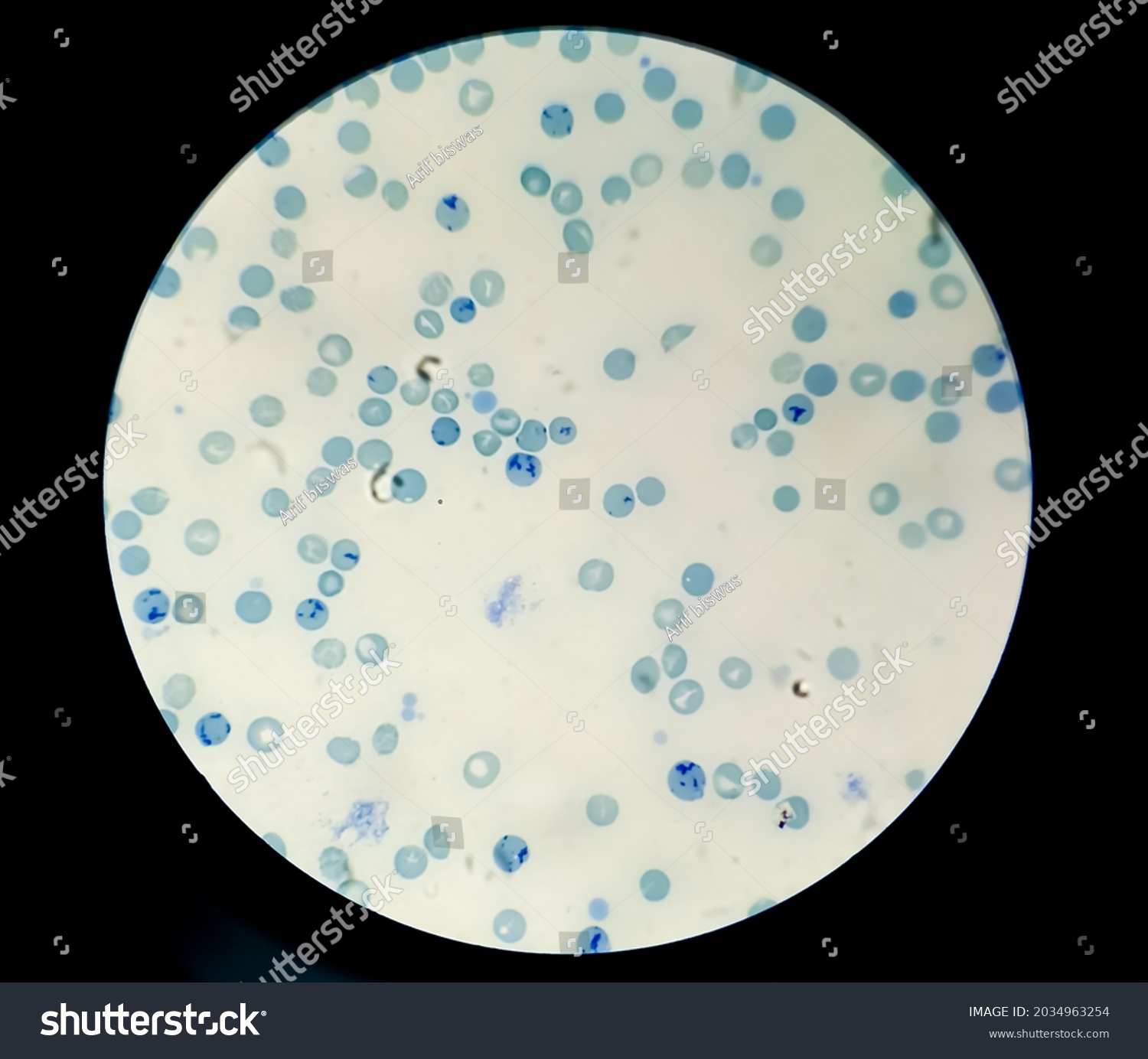 Blood Smear Under 100x Light Microscope Stock Photo 2034963254 ...