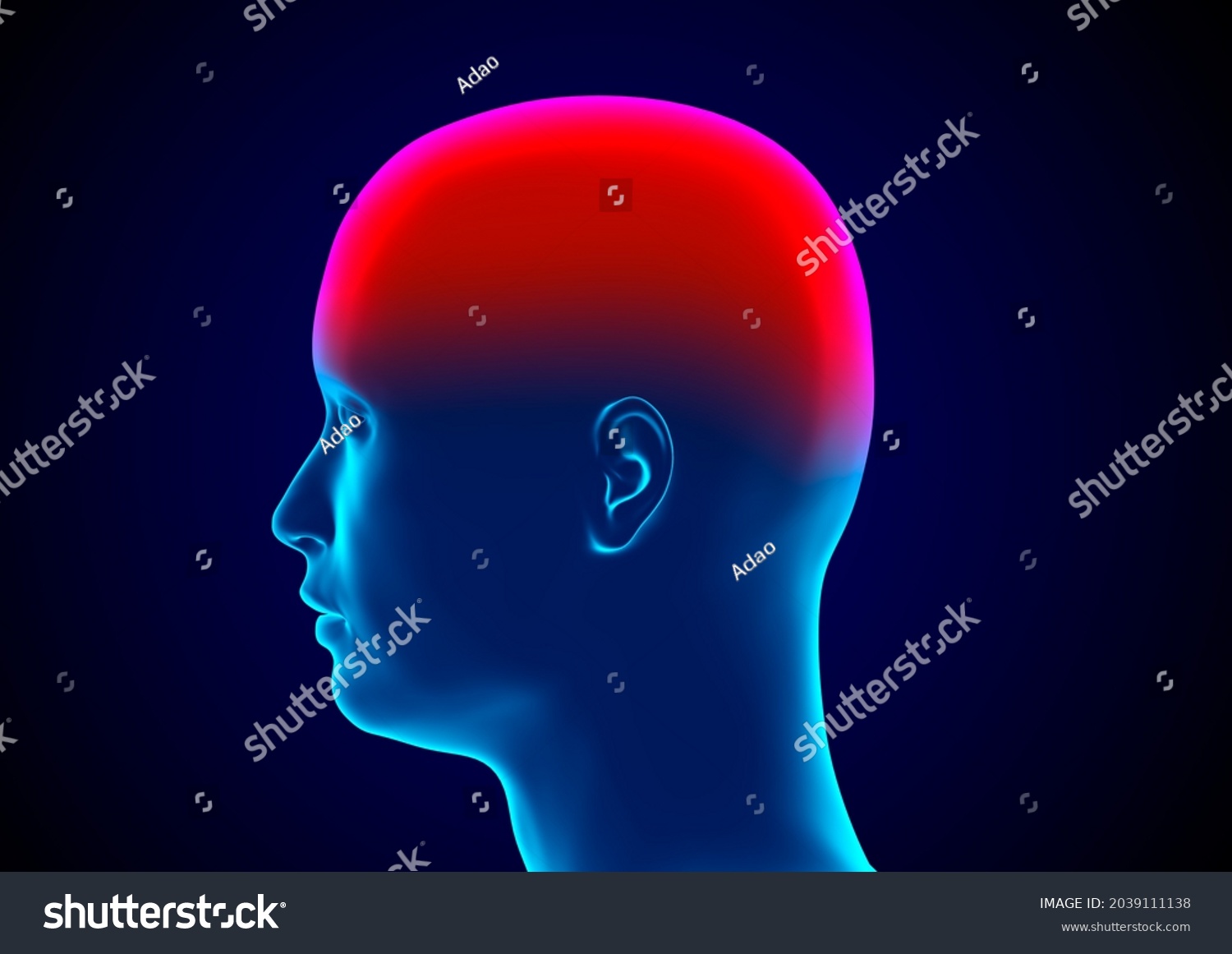 Meningitis Inflammation Meninges Membranes That Surround Stock Illustration 2039111138 4746