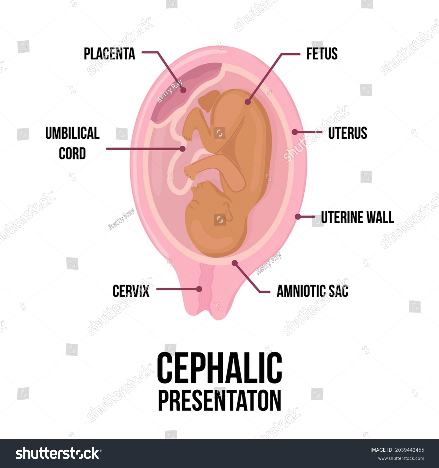 cephalic presentation diagram