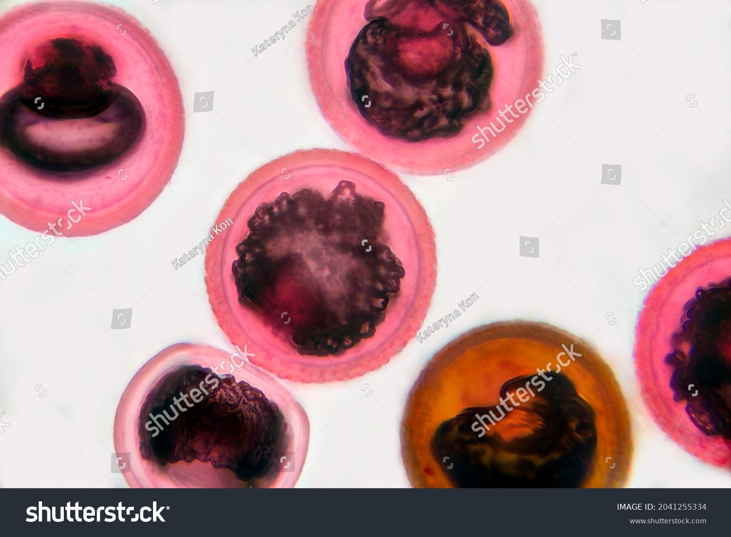 Eggs Tapeworm Taenia Pork Tapeworm Helminth Stock Photo 2041255334 ...