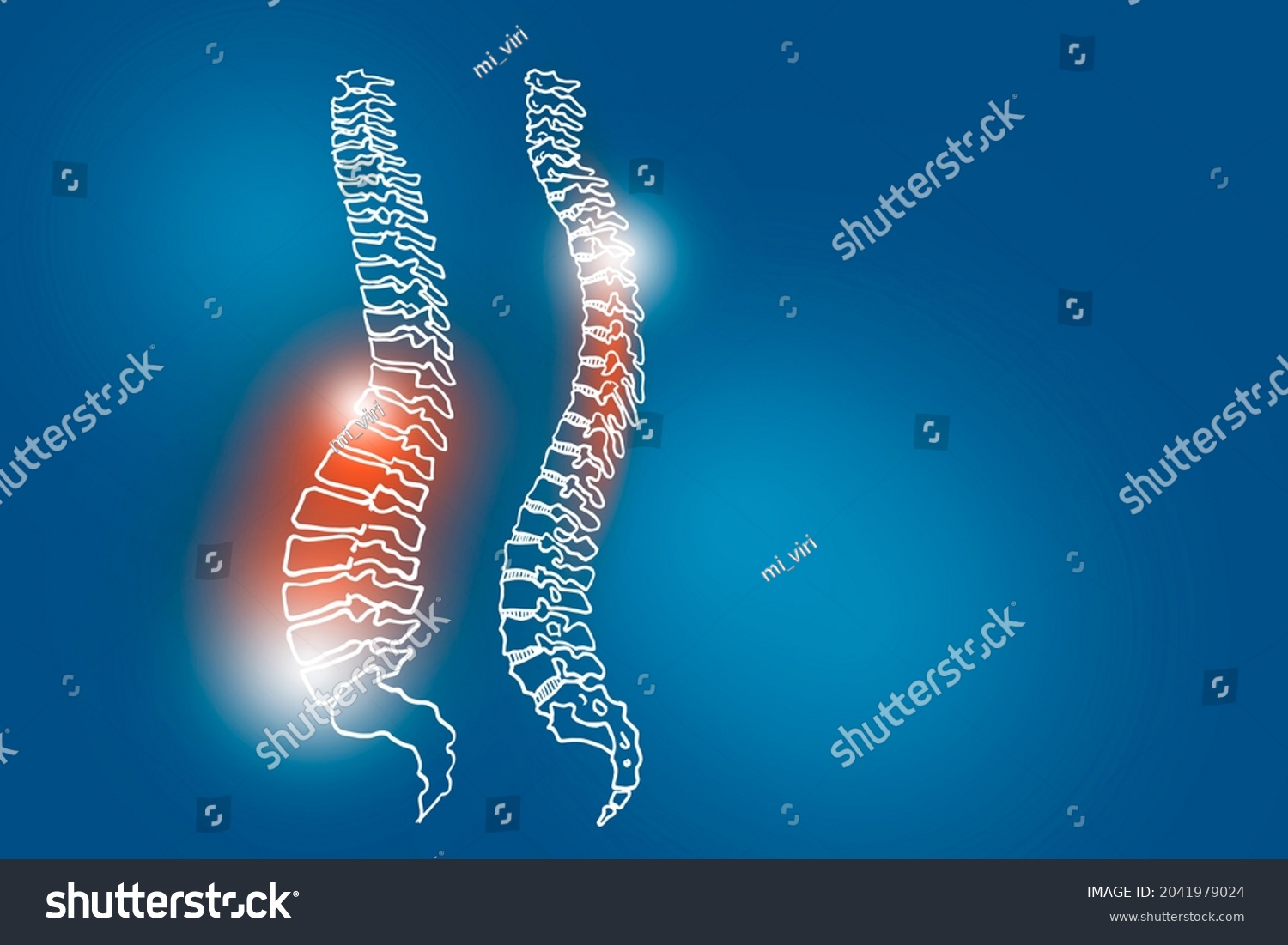 Handrawn Illustration Human Spine On Dark Stock Illustration 2041979024 ...