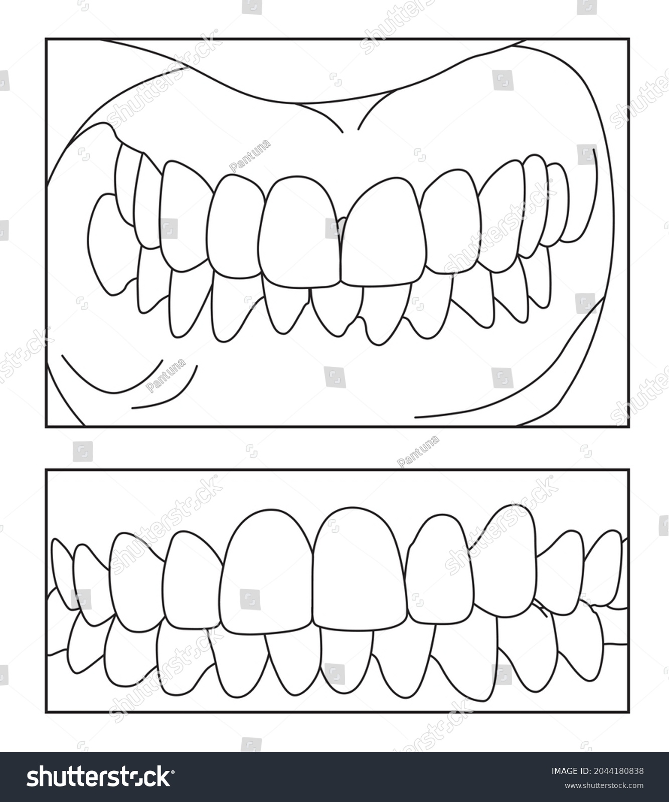 Teeth Denture Perfect Bite Smile Schemes Stock Vector (Royalty Free ...