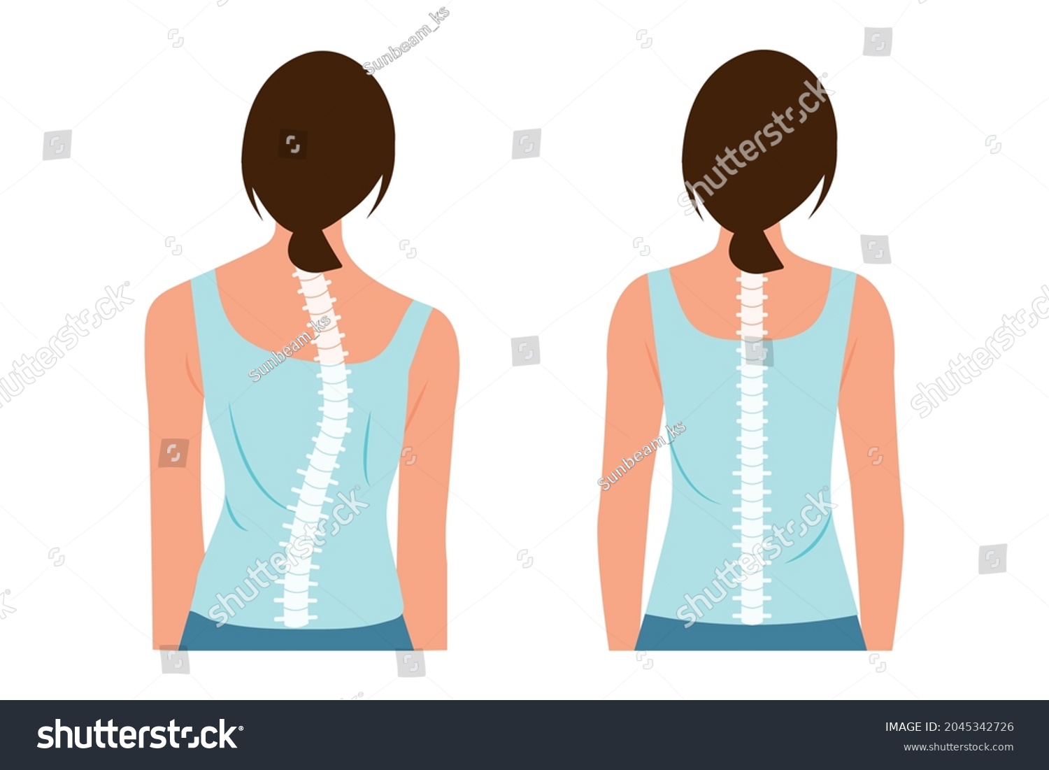 Good Posture Bad Posture Chiropractic Before Stock Vector (Royalty Free ...