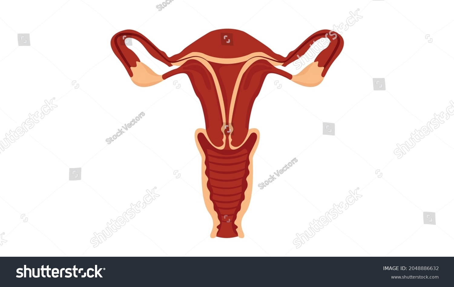 Uterine Fibroids Female Reproductive System Medical Stock Vector