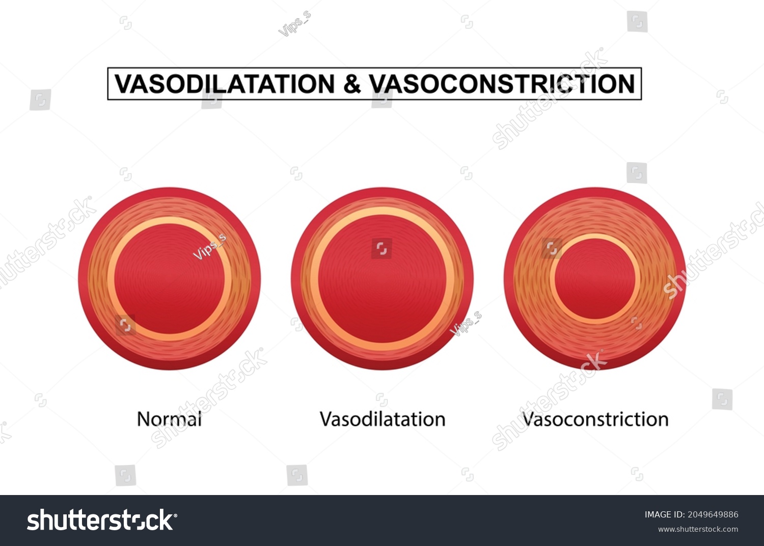 Vasodilation Vasoconstriction Comparison Blood Vessels Stock Vector ...