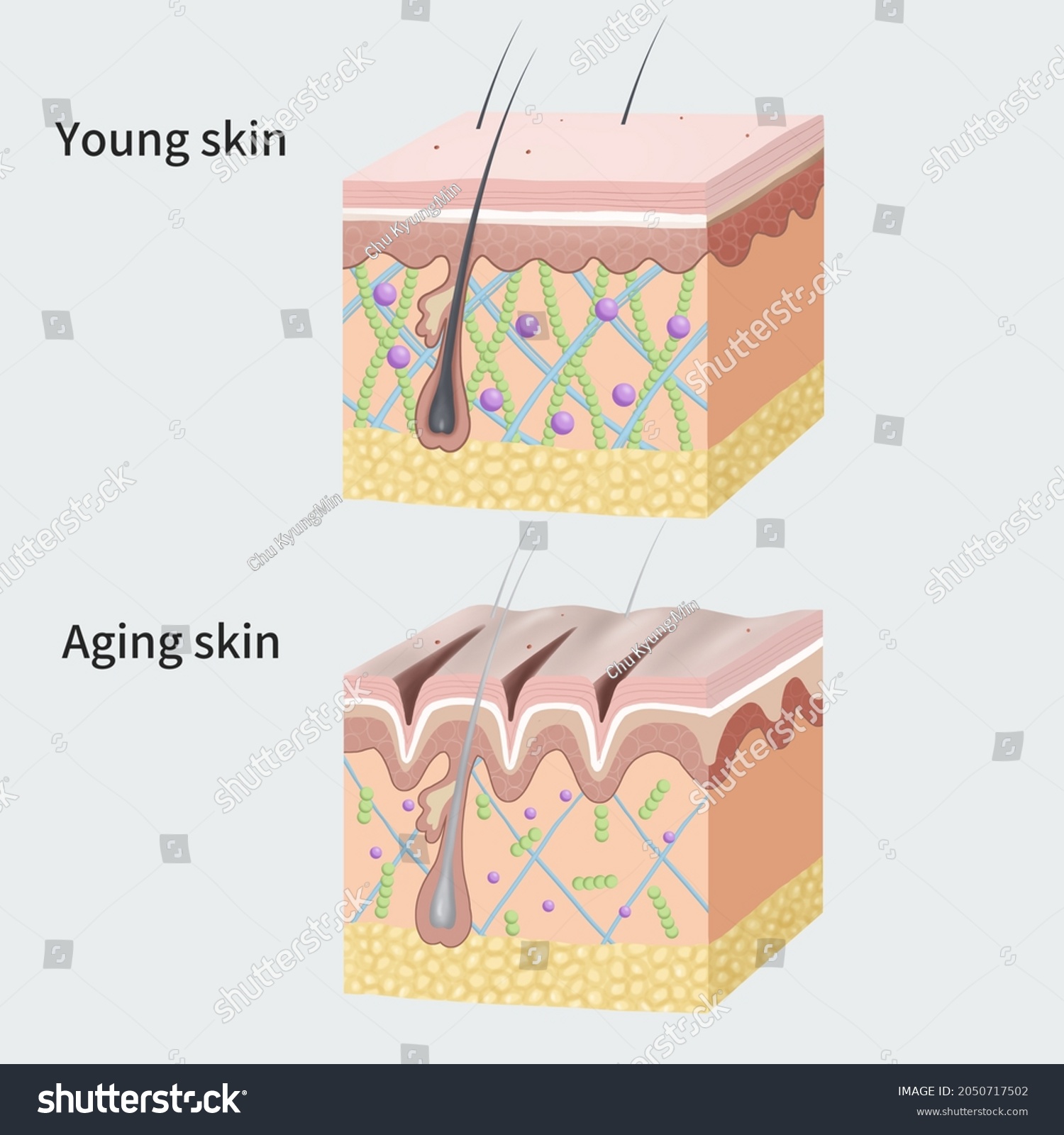 Medical Illustration Explain Aging Skin Stock Illustration 2050717502 