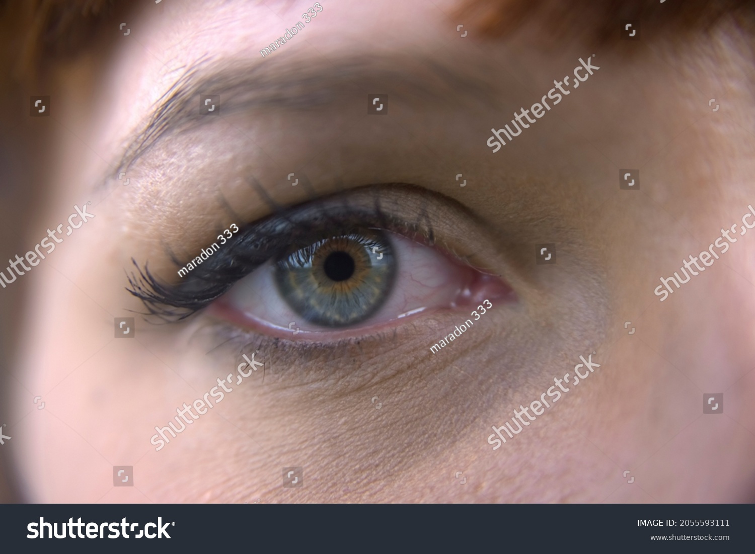 Стоковая фотография 2055593111 Young Woman Burst Blood Vessel Eye