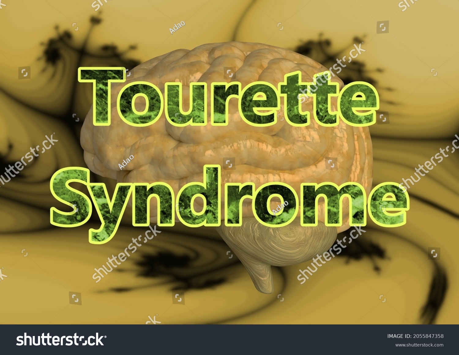 Lettering Tourette Syndrome Neurological Disorder That Stock Lettering Tourette Syndrome Neurological Disorder That Stock