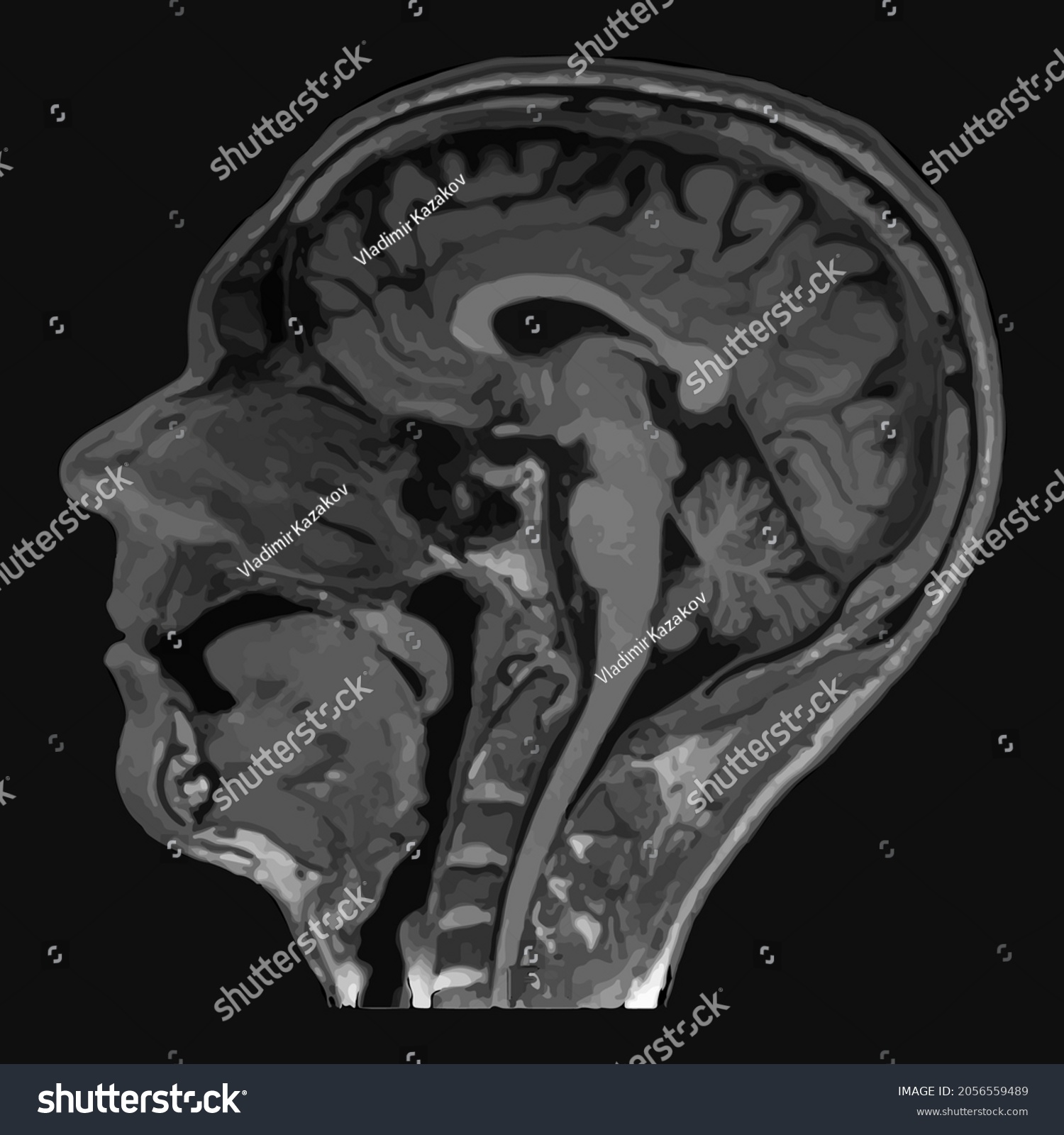 20 Mri Cervical Stock Vectors, Images & Vector Art | Shutterstock