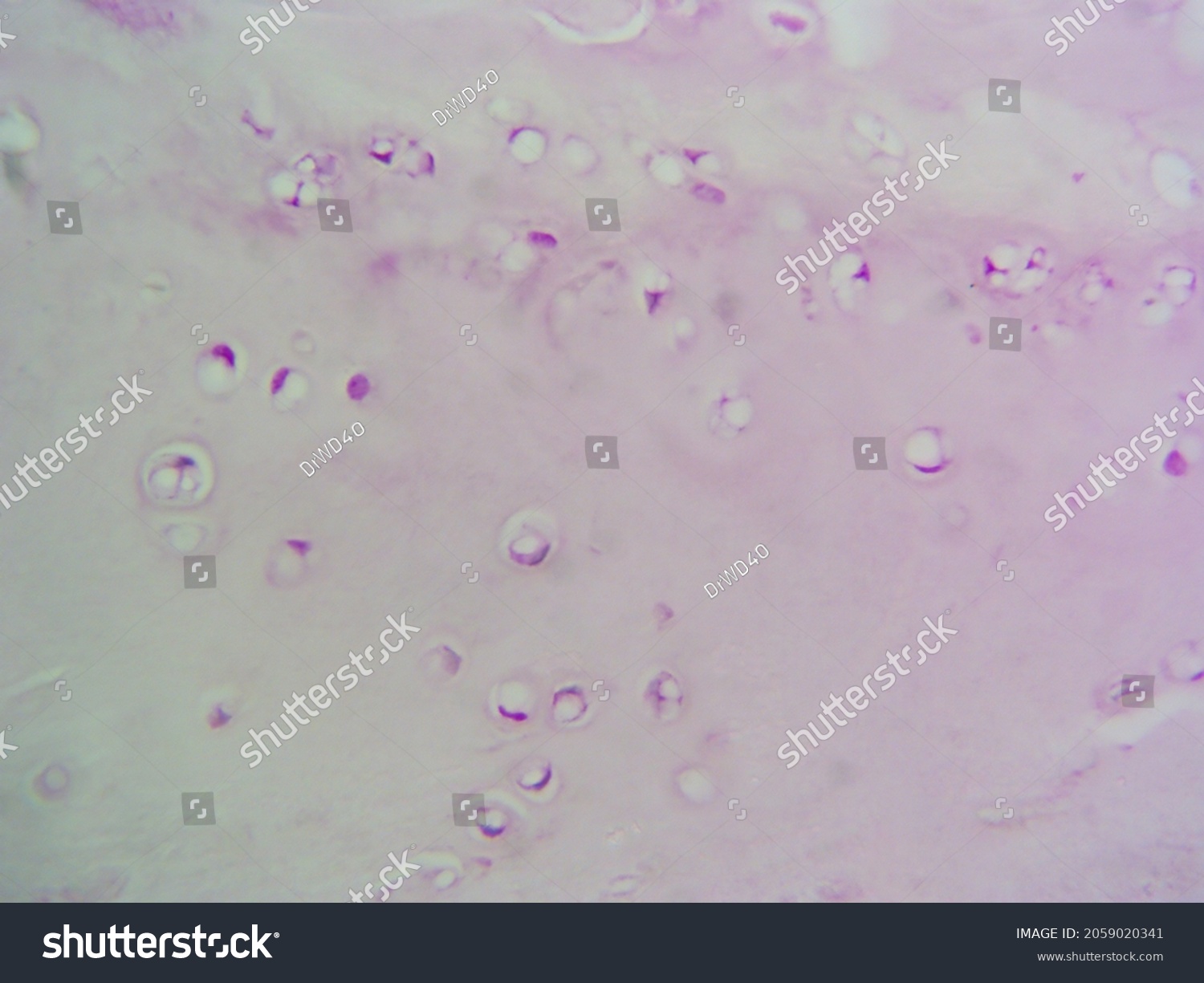 Histology Microscope Image White Fibrocartilage 400x Stock Photo ...