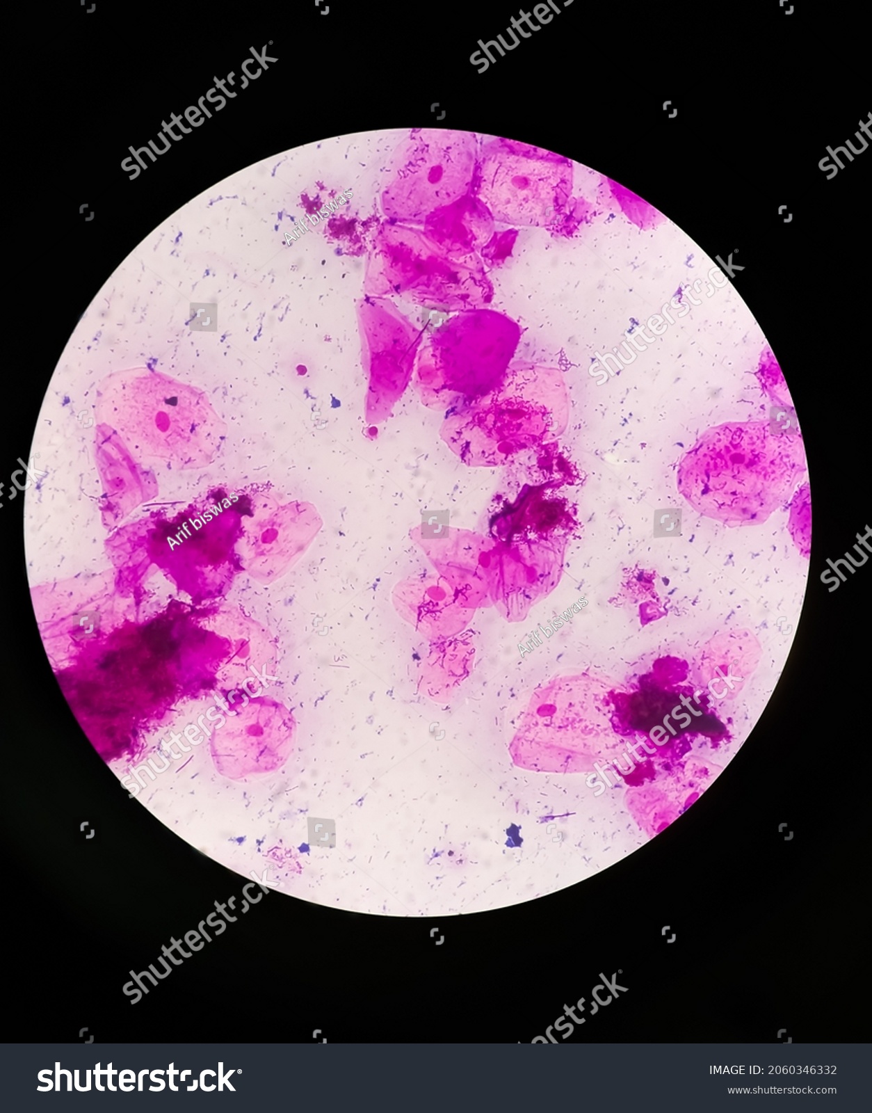 Prostatic Smear Ps Gram Stain Microscopic Stock Photo Shutterstock