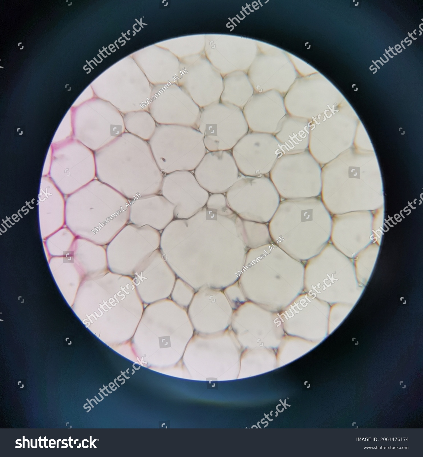 Photo Plant Tissue Section Show Cells Stock Photo 2061476174 