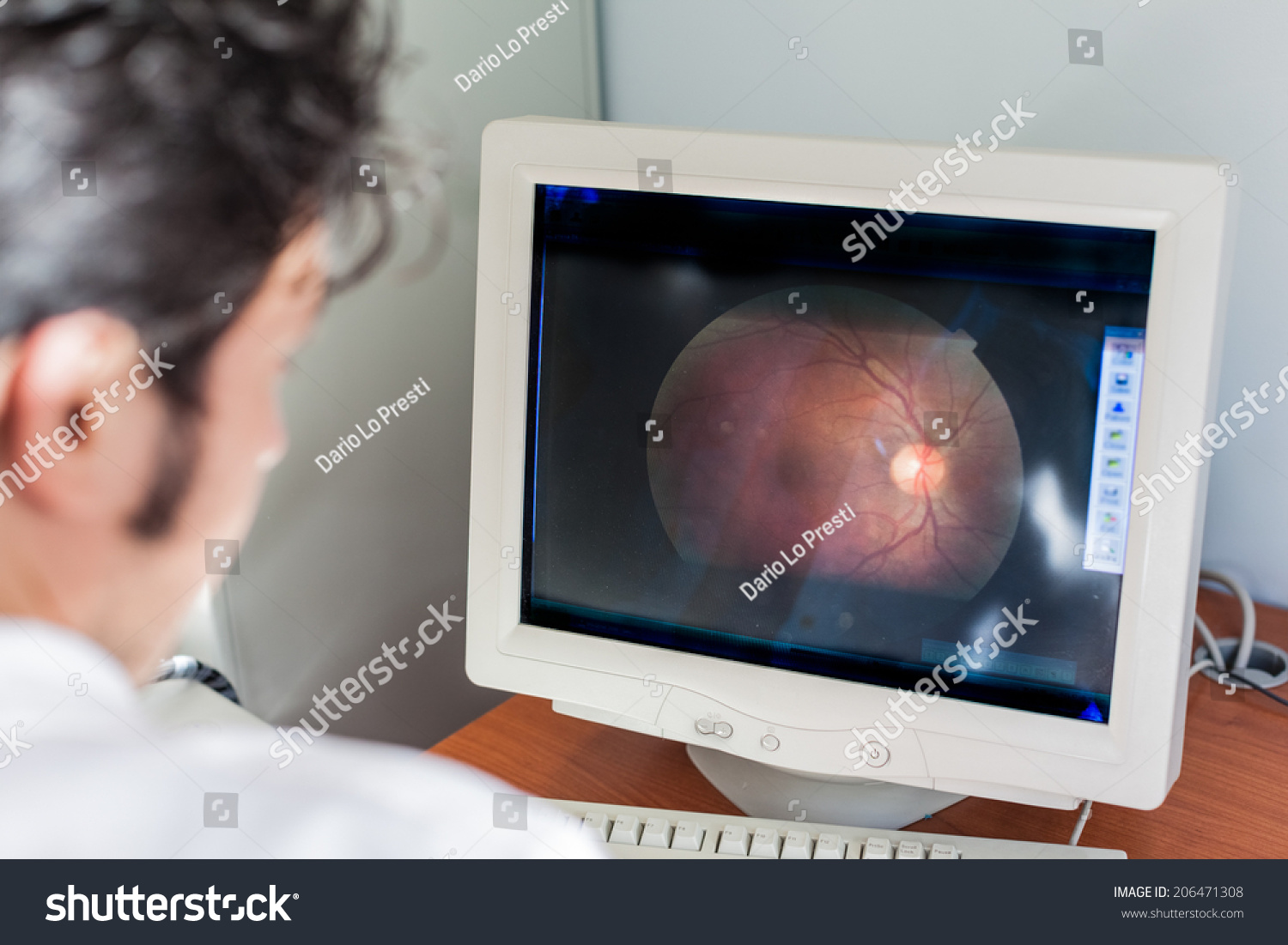 Young Ophthalmologist Looking Retina Scan Computer Stock Photo ...