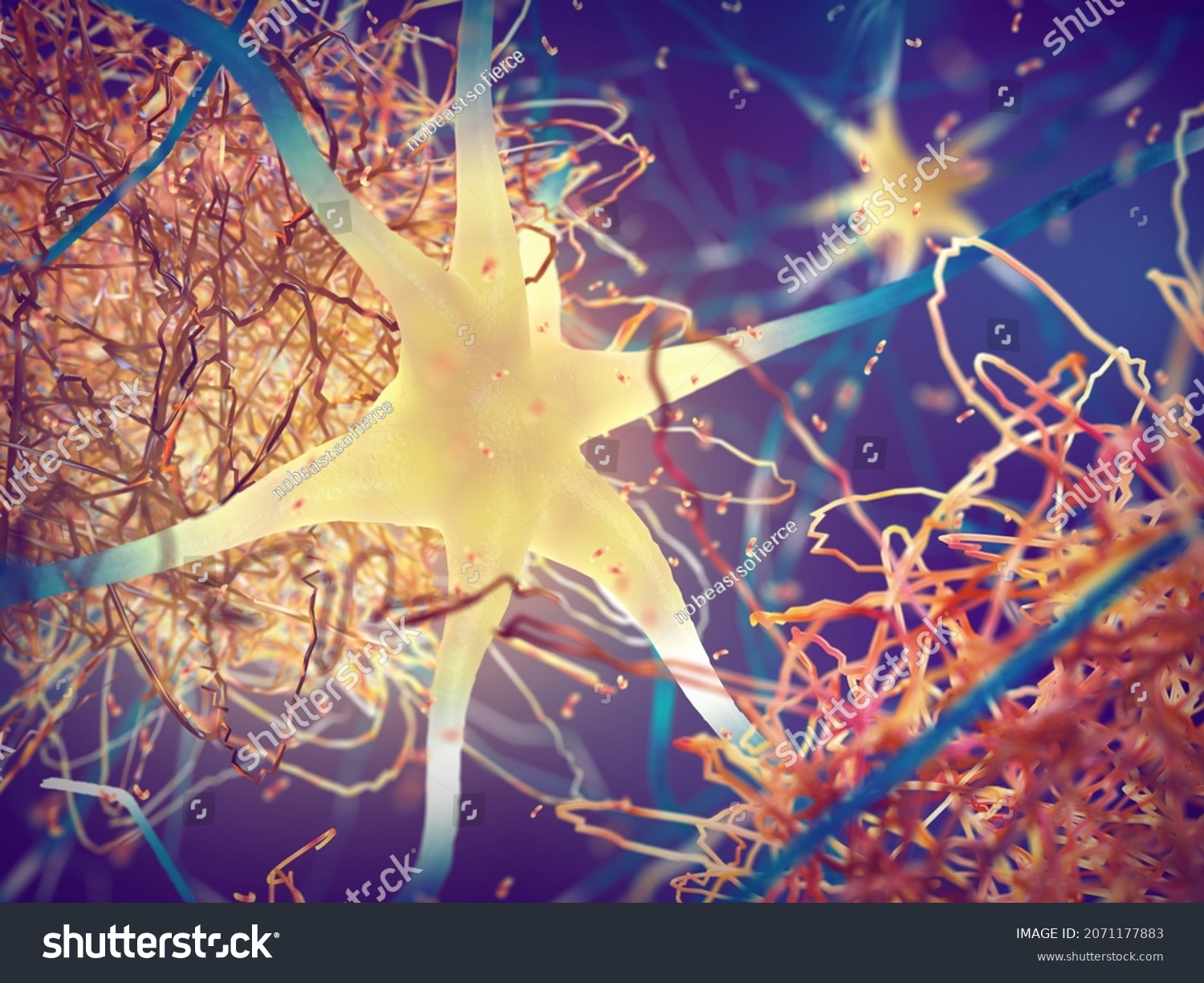 Amyloid Plaques Forming Between Neurons 3d Stock Illustration 2071177883 Shutterstock 