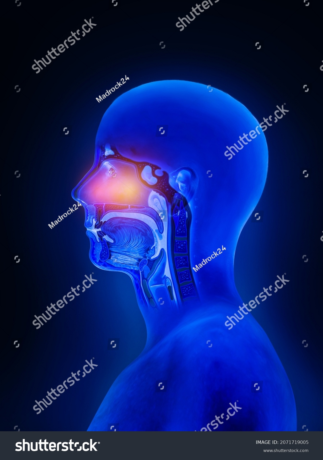 532 Respiratory Tract Infection Throat Images, Stock Photos & Vectors ...