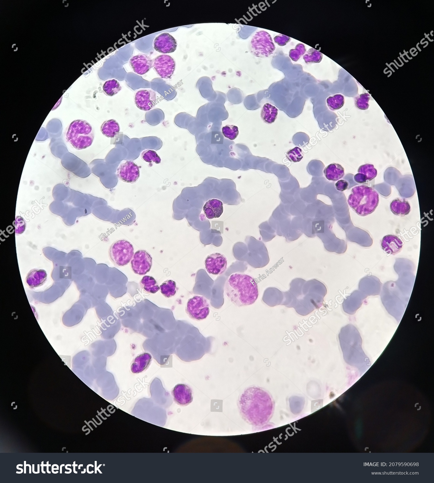 Neutrophil Under Microscope 100x Magnification Stock Photo 2079590698 ...