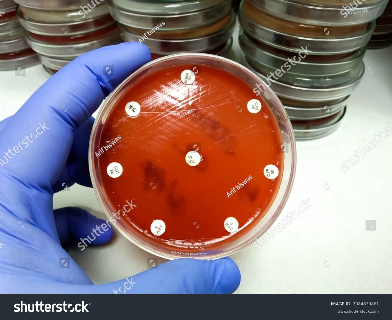 Antimicrobial Susceptibility Test Blood Agar Medium Stock Photo ...