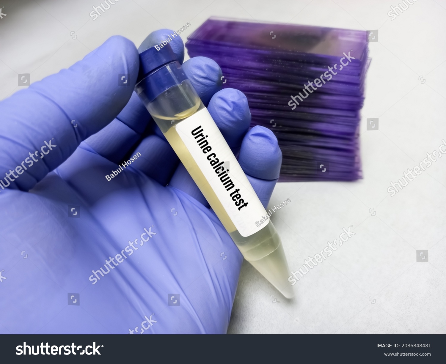 153-calcium-urine-test-images-stock-photos-vectors-shutterstock