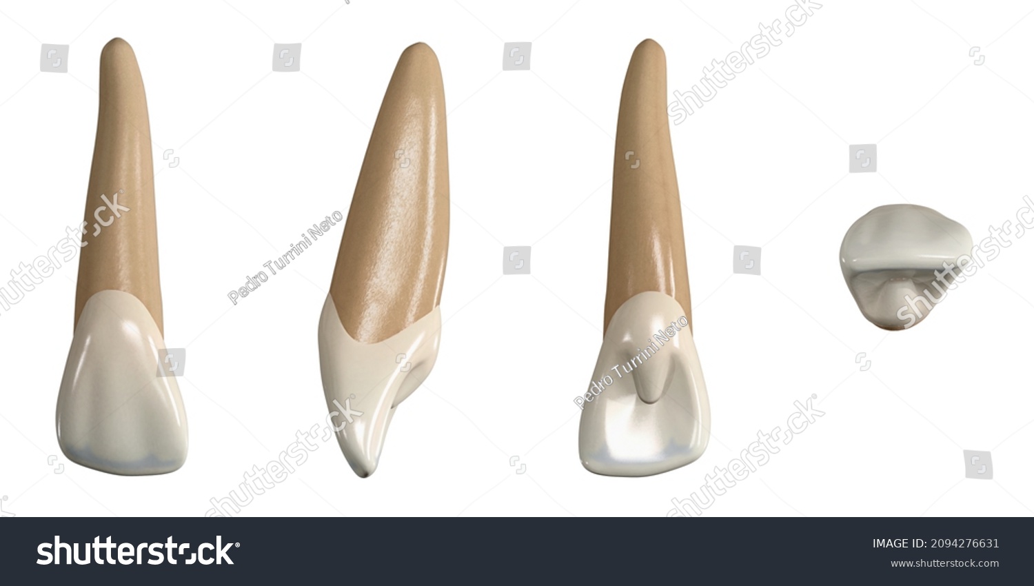 Permanent Upper Lateral Incisor Tooth 3d Stock Illustration 2094276631 ...