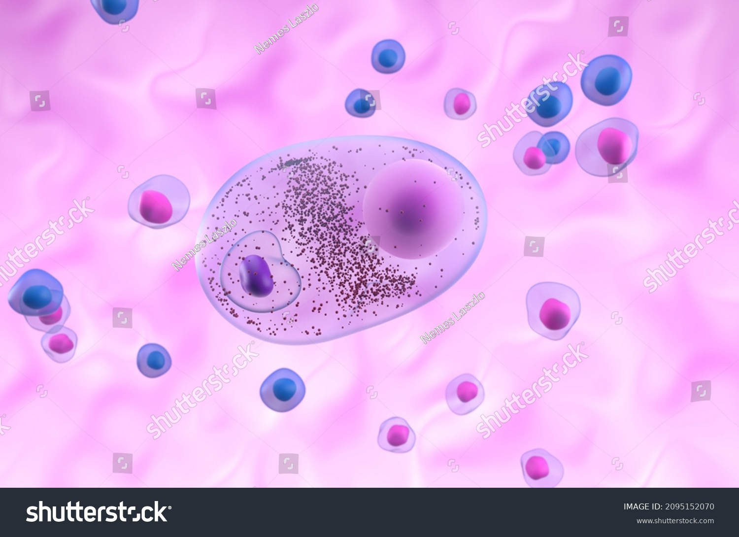 Lewy Body Parkinsons Disease Pd Dementia Stock Illustration 2095152070
