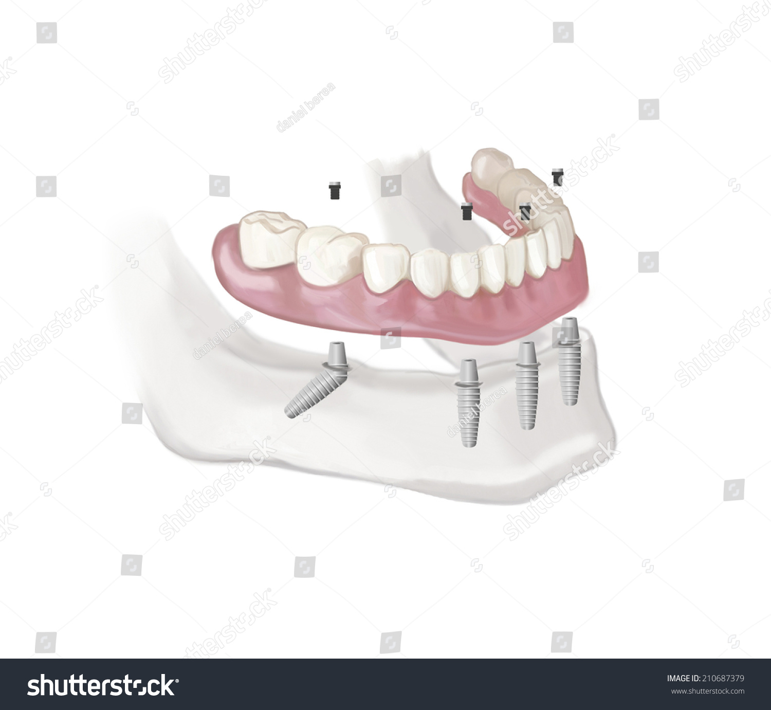 Зубы все на четырех