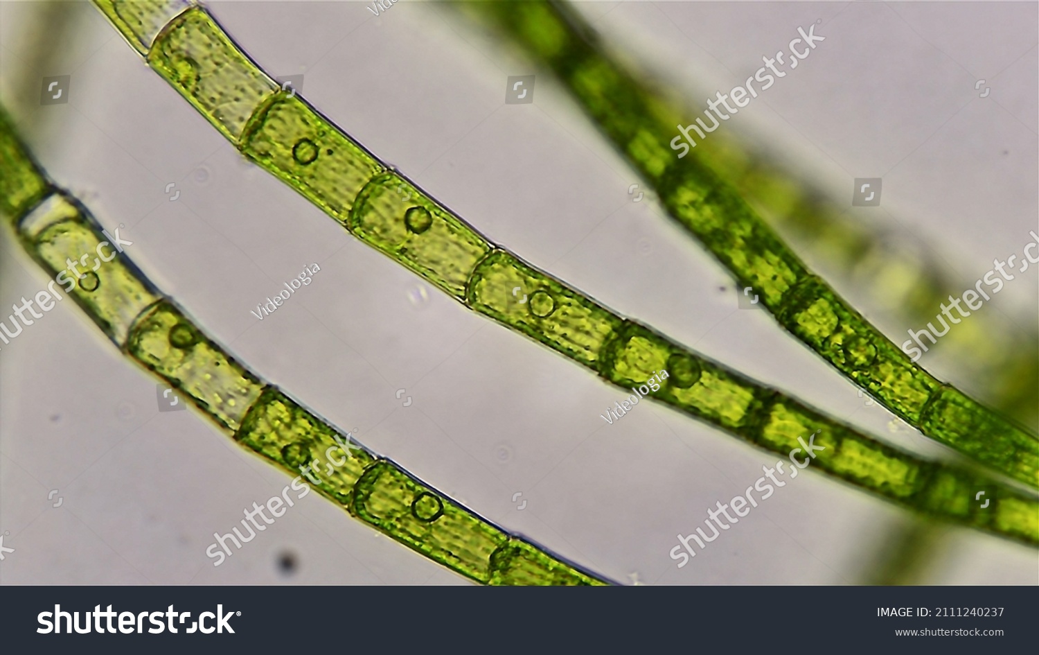 oedogonium under microscope labeled