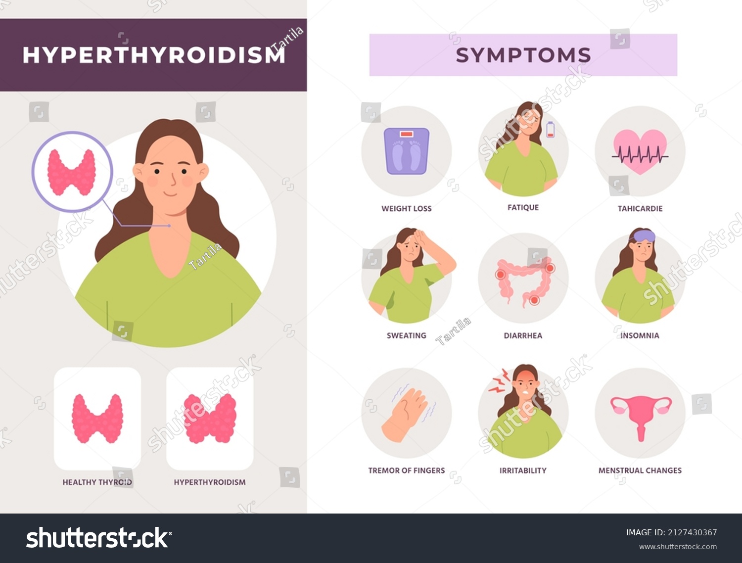 Comportamiento de personas con hipertiroidismo
