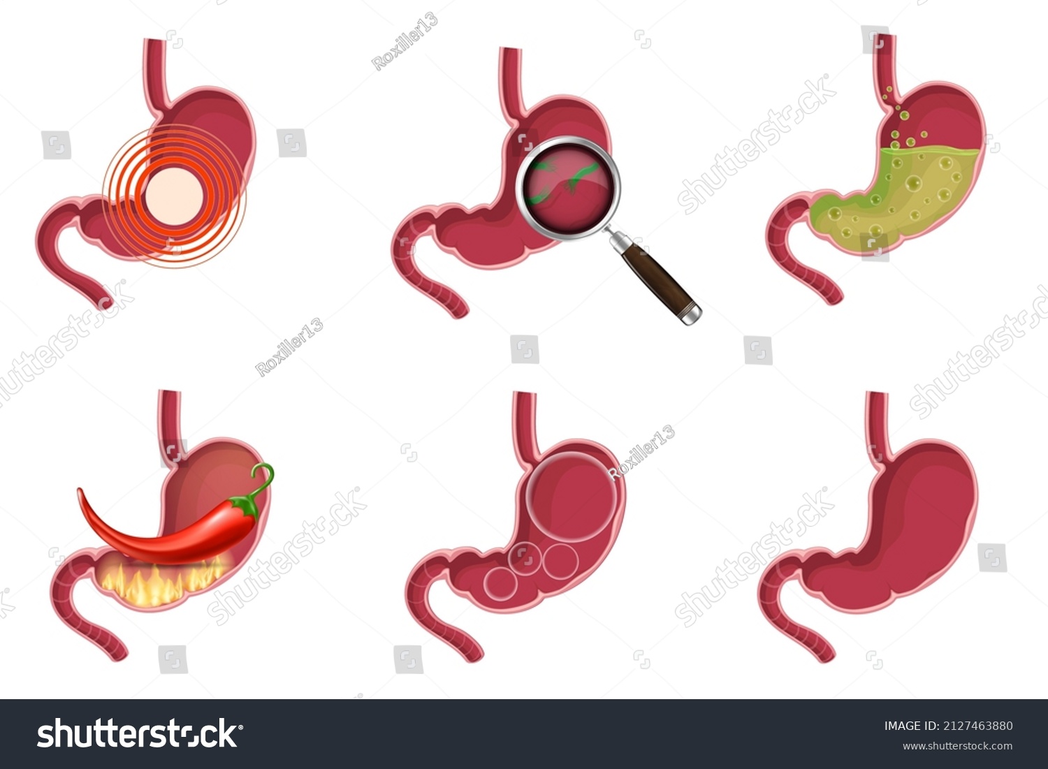 Healthy Unhealthy Empty Full Human Stomach Stock Vector (Royalty Free ...