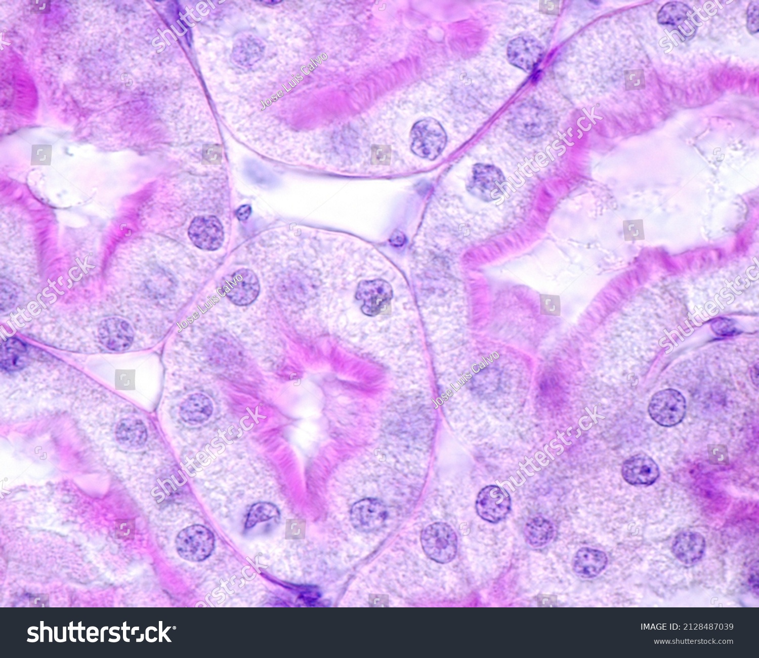 High Magnification Micrograph Showing Kidney Proximal Stock Photo ...