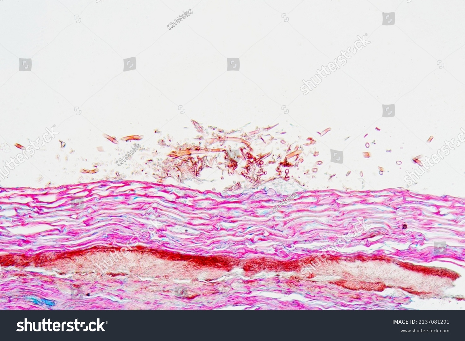 Plant Pathogen Botrytis Allii Under Microscope Stock Photo 2137081291 ...