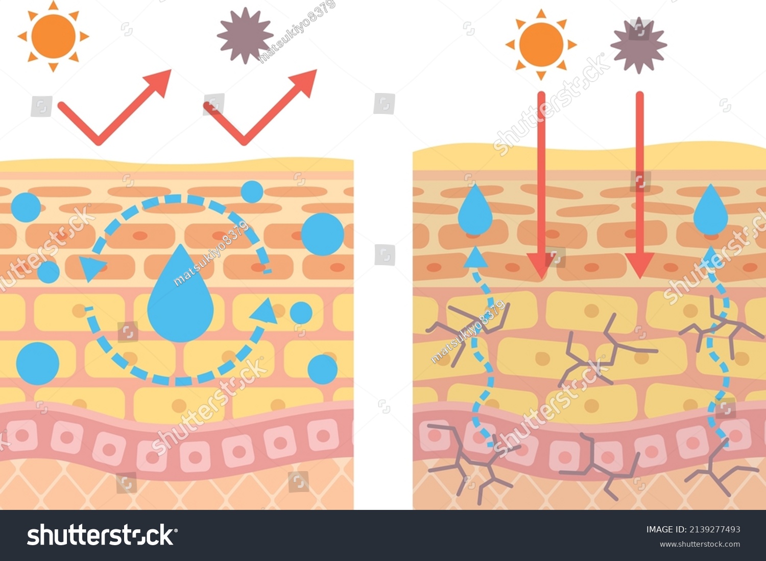 Structural Diagram Skin Inner Dry Skin Stock Vector (Royalty Free ...