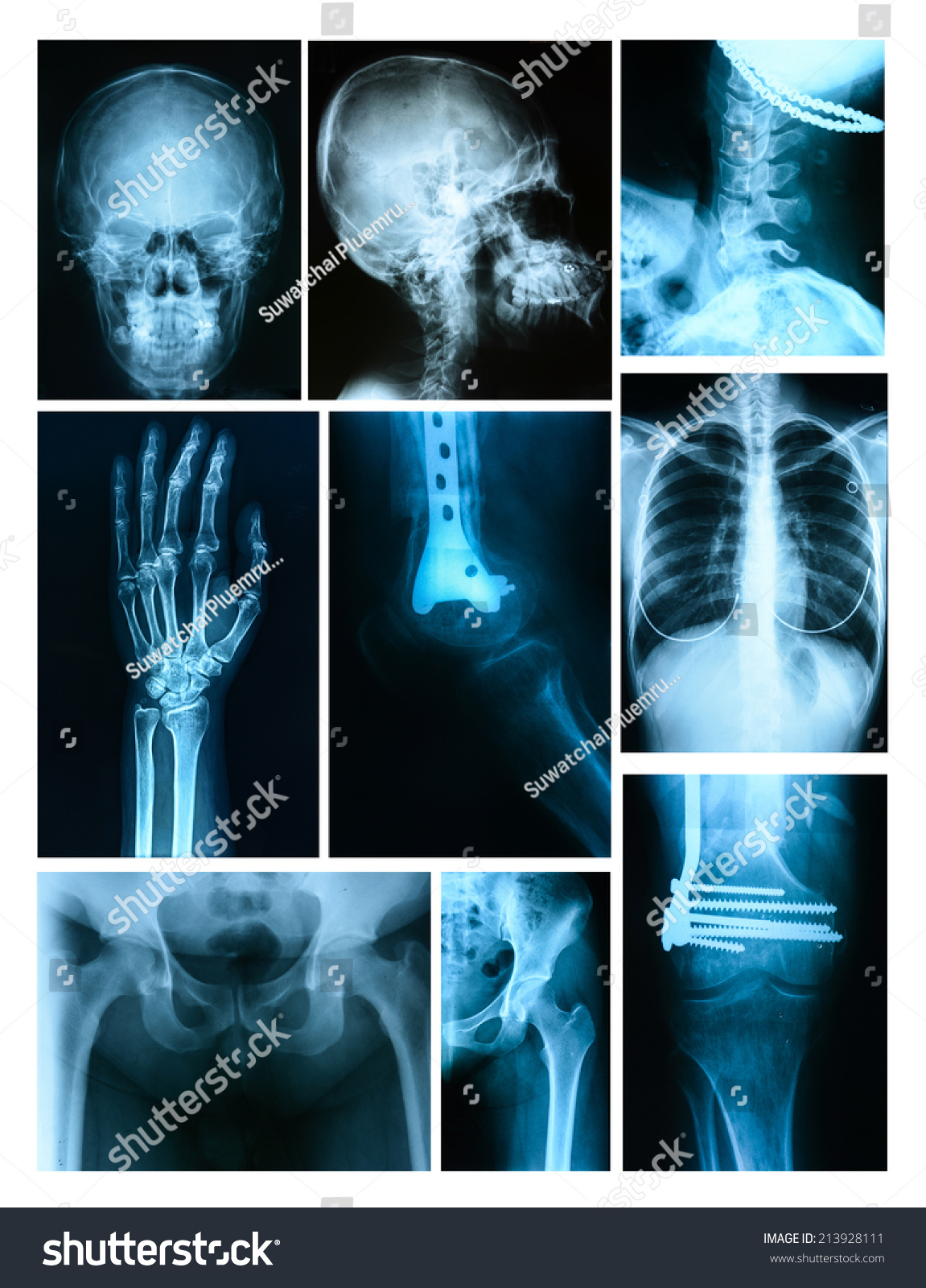 Collage Many Xrays Very Good Quality Stock Photo 213928111 | Shutterstock