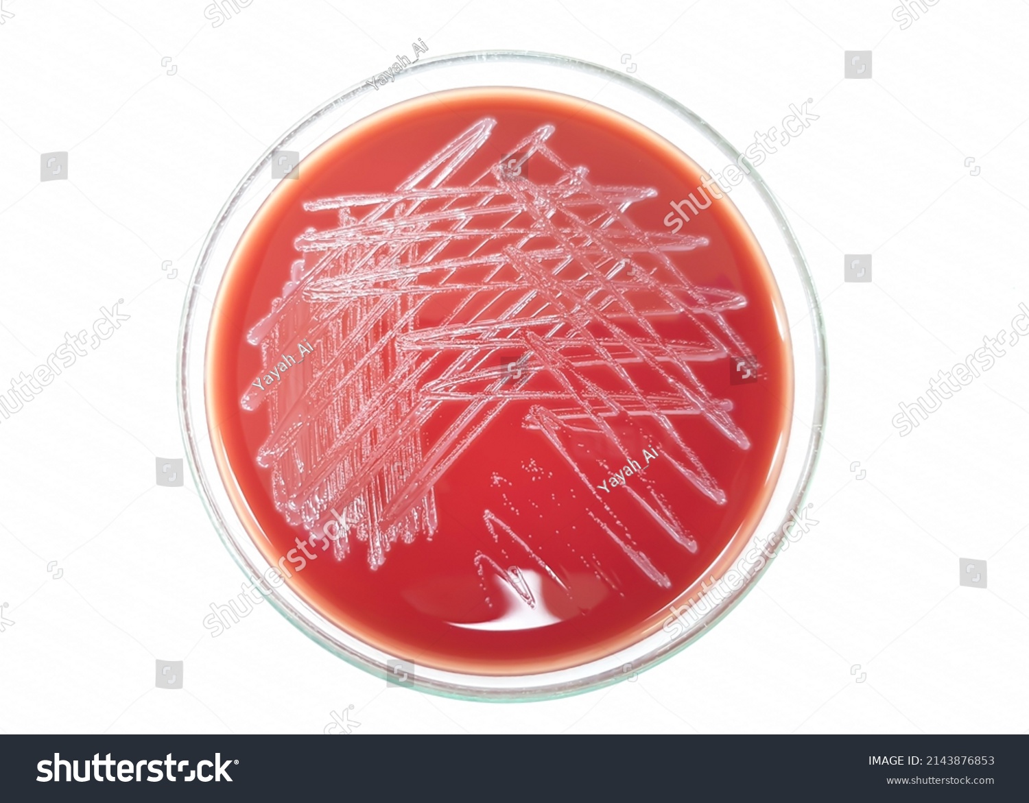 Closeup Trueperella Pyogenes Bacterial Colonies Growth Stock Photo ...