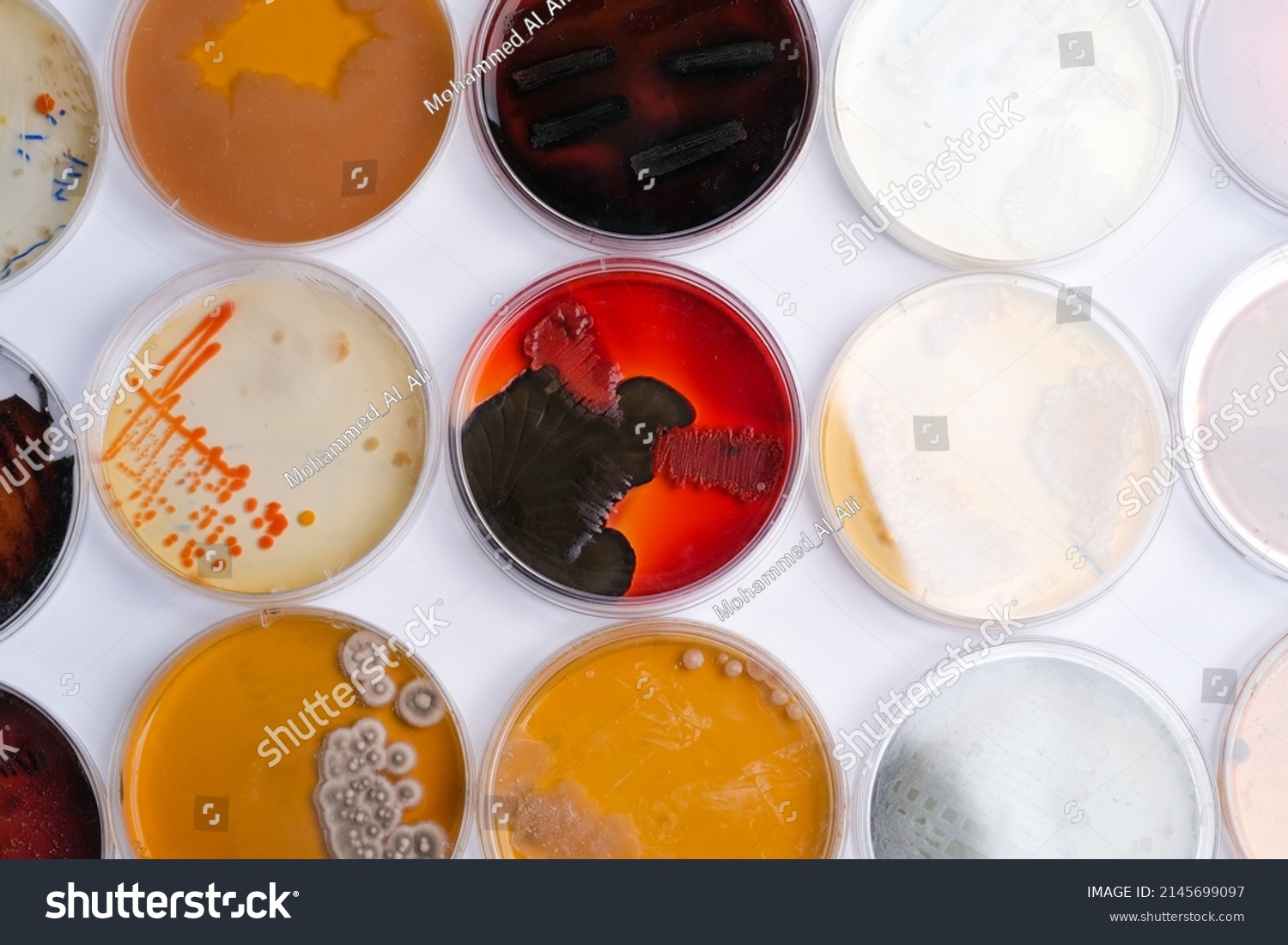 Collection Petri Dishes Contain Growth Ofbacterial Stock Photo ...