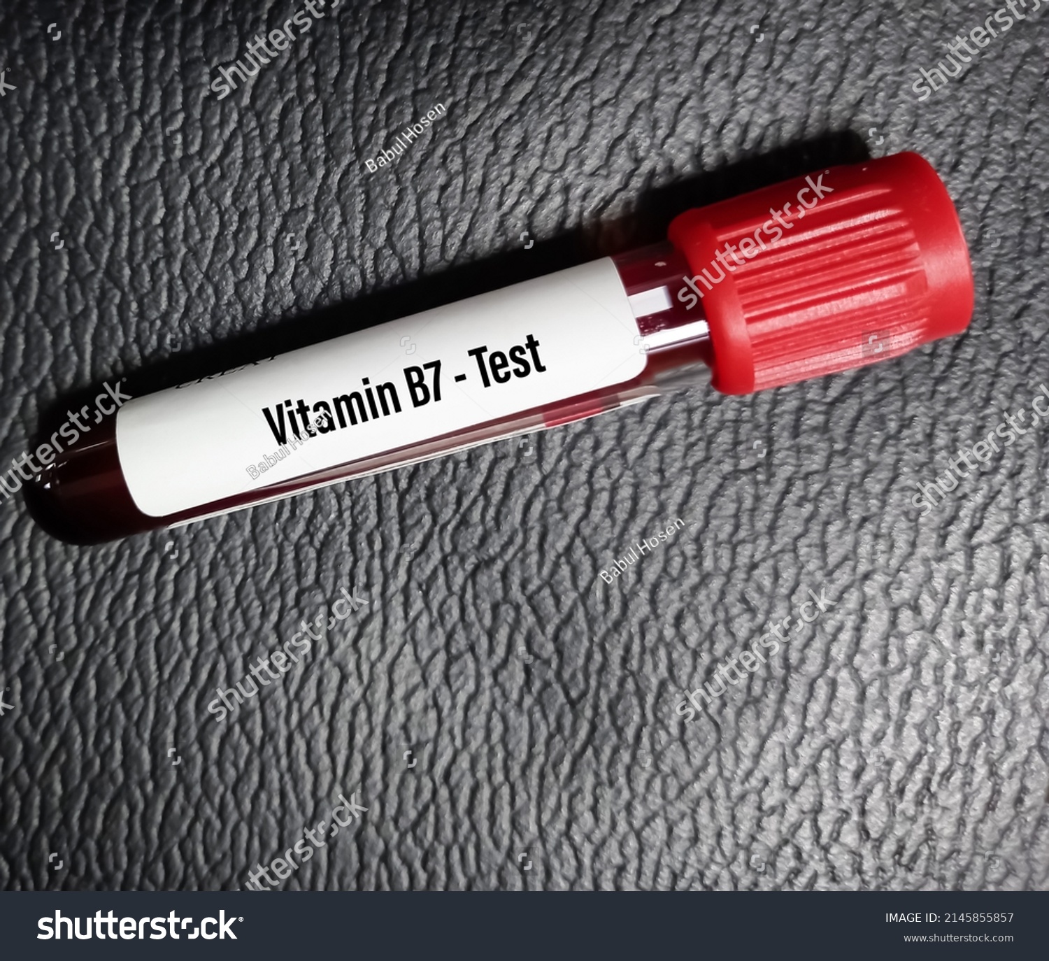 Blood Sample Vitamin B7 Biotin Test Stock Photo 2145855857 | Shutterstock