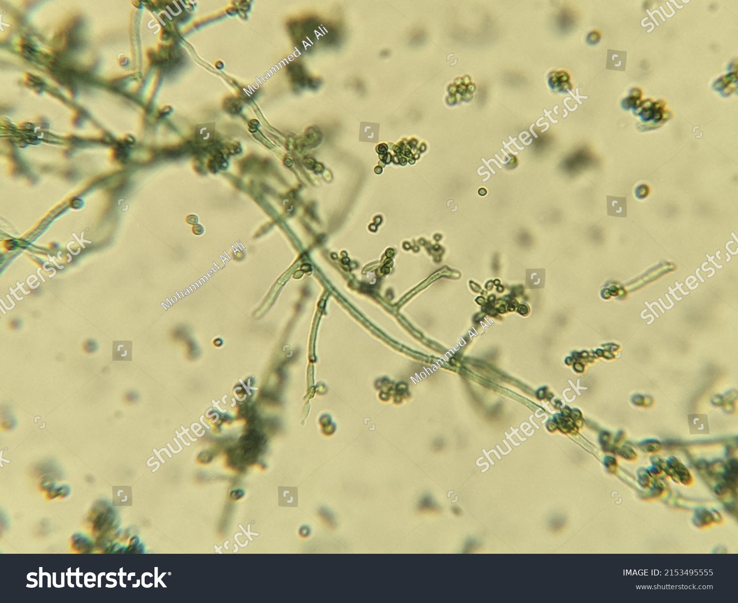 Photo Fungi Hyphae Spores Under Microscope Stock Photo 2153495555 ...