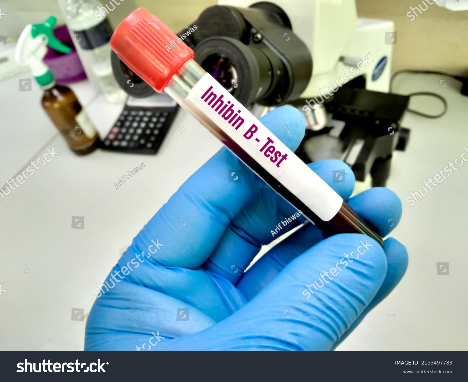 Blood Sample Inhibin B Test Medical Stock Photo 2153497783 | Shutterstock