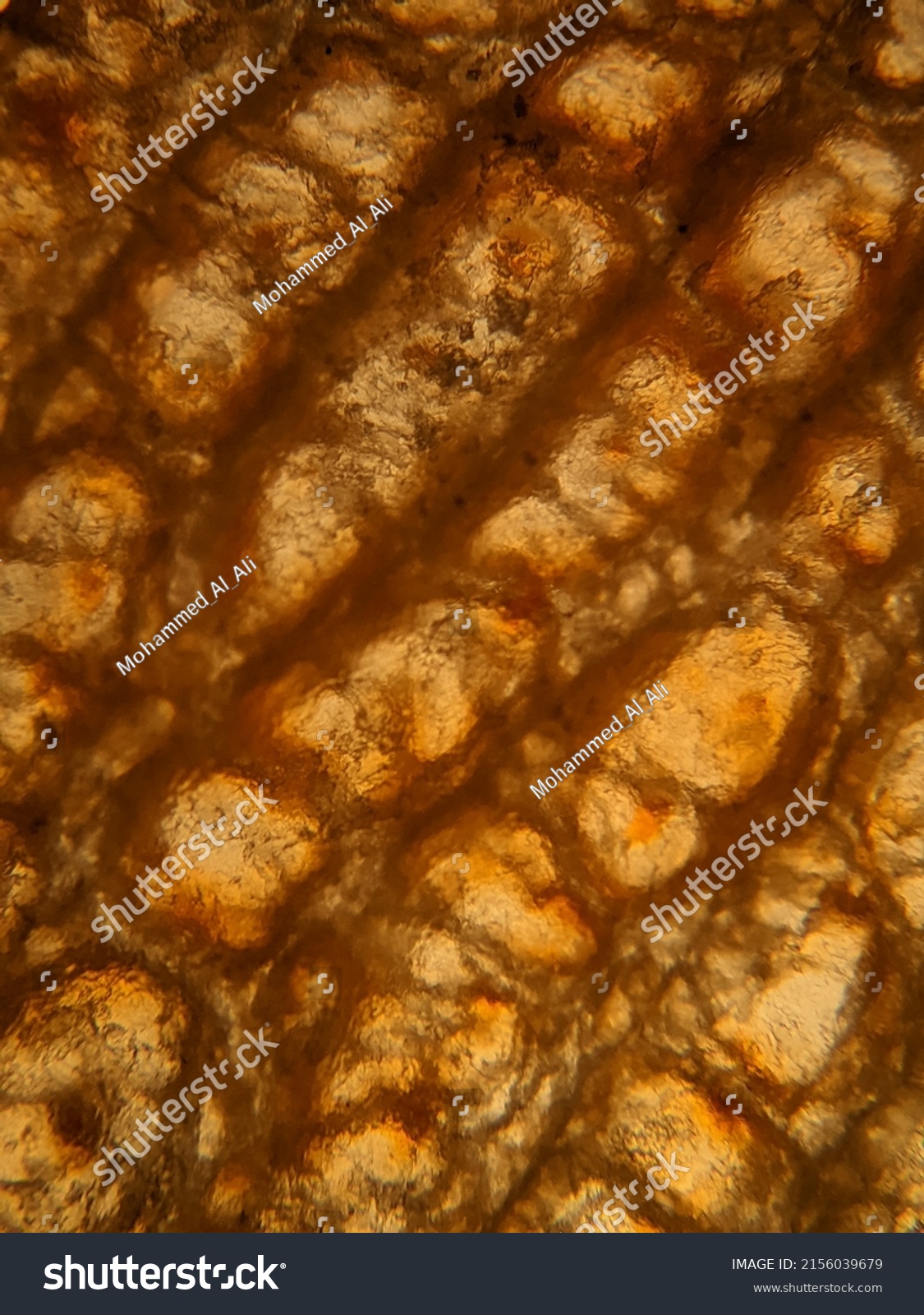 Photo Human Foot Skin Under Microscope Stock Photo 2156039679