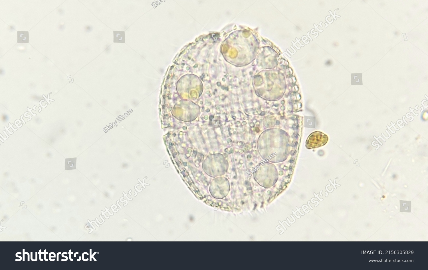 Protist Called Coleps Sp 400x Microscope Stock Photo 2156305829 ...