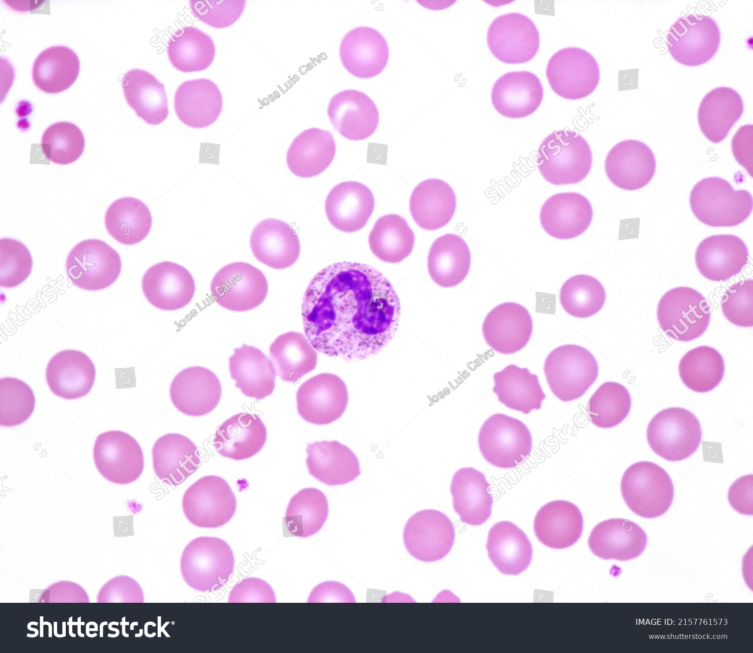 Human Blood Smear Where Immature Neutrophil Stock Photo 2157761573 ...